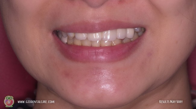 get-your-smile-here--1